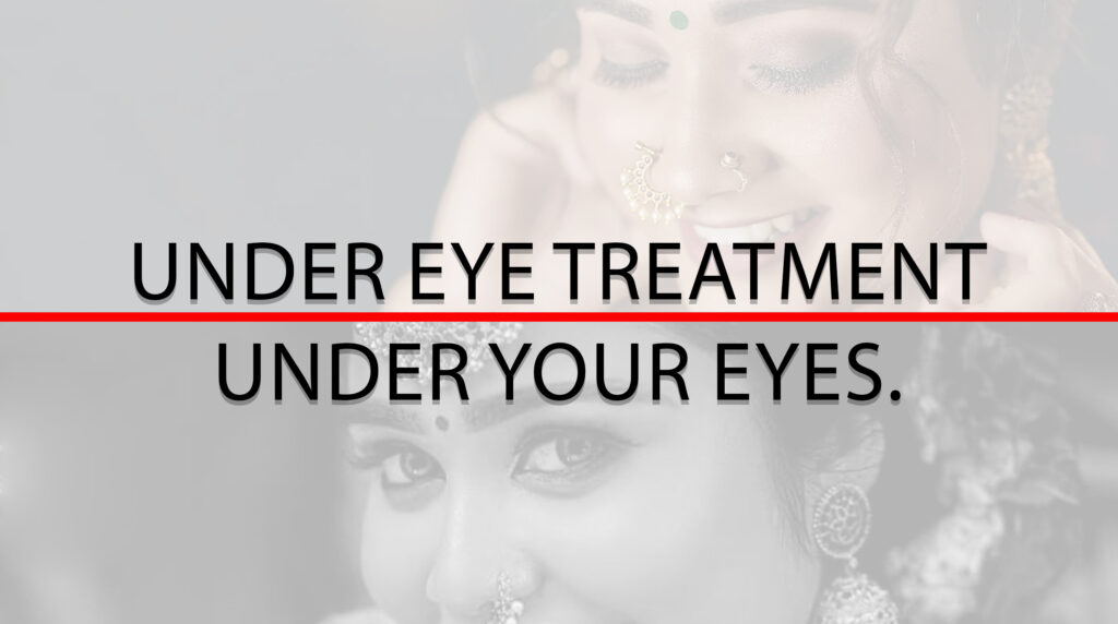 under eye treatment.Under Your Eyes.